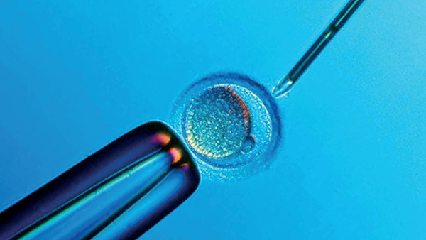 三代试管婴儿胚胎植入前遗传学诊断PGD