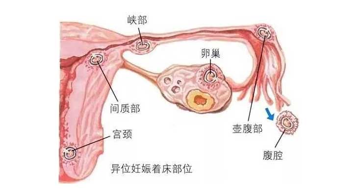 胚胎着床部位分析